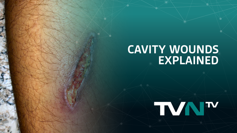 devitalised-non-viable-tissue-explained-tvn-tv